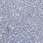 Immunohistochemical staining of human liver shows no positivity in hepatocytes as expected.
