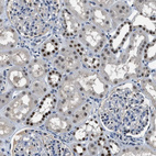 Anti-ALX1 Antibody