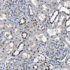 Anti-ALX1 Antibody