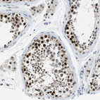Immunohistochemical staining of human testis shows strong nuclear positivity in cells in seminiferous ducts.