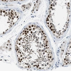 Immunohistochemical staining of human testis shows strong nuclear positivity in cells in seminiferous ducts.