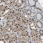 Immunohistochemical staining of human stomach shows strong nuclear positivity in glandular cells.
