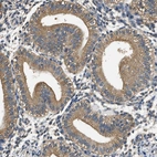 Immunohistochemical staining of human endometrium shows moderate cytoplasmic positivity in glandular cells.