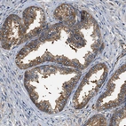 Immunohistochemical staining of human prostate shows moderate cytoplasmic positivity in glandular cells.