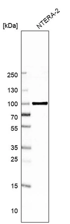 Western blot analysis in human cell line NTERA-2.