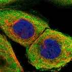 Immunofluorescent staining of human cell line A-431 shows localization to plasma membrane & cytosol.