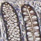 Immunohistochemical staining of human colon using Anti-FHIT antibody HPA018909.