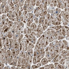Anti-ETFB Antibody