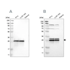 Western blot analysis using Anti-ETFB antibody HPA018910 (A) shows similar pattern to independent antibody HPA018921 (B).
