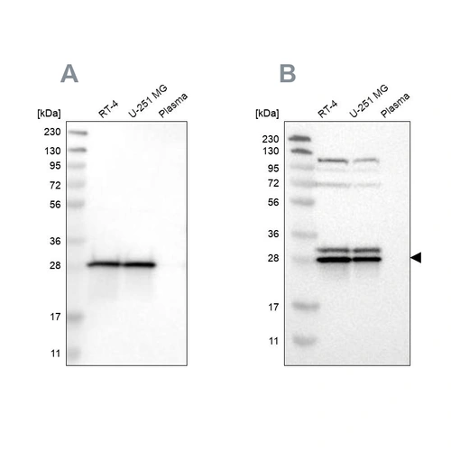 Anti-ETFB Human Protein Atlas Antibody