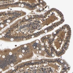 Immunohistochemical staining of human duodenum shows moderate cytoplasmic positivity in glandular cells.