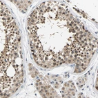 Immunohistochemical staining of human testis shows moderate cytoplasmic and nucleus positivity in cells in seminiferous ducts and moderate cytoplasmic positivity in Leydig cells.