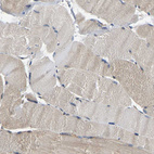 Immunohistochemical staining of human skeletal muscle shows moderate cytoplasmic positivity in myocytes.