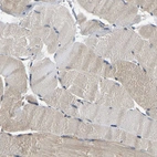 Immunohistochemical staining of human skeletal muscle shows moderate cytoplasmic positivity in myocytes.