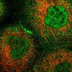 Immunofluorescent staining of human cell line A-431 shows localization to nucleoplasm, plasma membrane & cytosol.