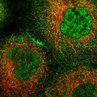 Immunofluorescent staining of human cell line A-431 shows localization to nucleoplasm, plasma membrane & cytosol.