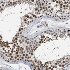 Anti-GGNBP2 Antibody
