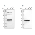 Western blot analysis using Anti-ETFB antibody HPA018921 (A) shows similar pattern to independent antibody HPA018910 (B).