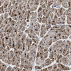 Anti-ETFB Antibody