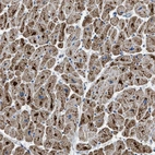 Anti-ETFB Antibody