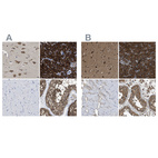 Immunohistochemical staining of human cerebral cortex, pancreas, skeletal muscle and testis using Anti-YARS antibody HPA018950 (A) shows similar protein distribution across tissues to independent antibody HPA017936 (B).