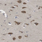 Immunohistochemical staining of human cerebral cortex shows moderate cytoplasmic positivity in neurons.