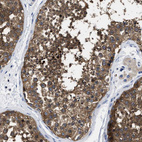 Immunohistochemical staining of human testis shows strong cytoplasmic positivity in cells in seminiferous ducts.