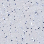 Immunohistochemical staining of human skeletal muscle shows no positivity in myocytes as expected.