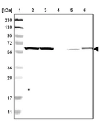 Lane 1: Marker [kDa] 230, 130, 95, 72, 56, 36, 28, 17, 11_br/_Lane 2: Human cell line RT-4_br/_Lane 3: Human cell line U-251MG sp_br/_Lane 4: Human plasma (IgG/HSA depleted)_br/_Lane 5: Human liver tissue_br/_Lane 6: Human tonsil tissue