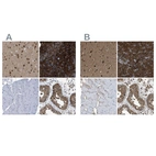 Immunohistochemical staining of human cerebral cortex, pancreas, skeletal muscle and testis using Anti-YARS antibody HPA018954 (A) shows similar protein distribution across tissues to independent antibody HPA017936 (B).