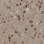Immunohistochemical staining of human cerebral cortex shows moderate cytoplasmic positivity in neurons.