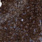 Immunohistochemical staining of human pancreas shows strong cytoplasmic positivity in exocrine glandular cells.