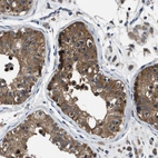 Immunohistochemical staining of human testis shows strong cytoplasmic positivity in cells in seminiferous ducts.