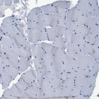 Immunohistochemical staining of human skeletal muscle shows no positivity in myocytes as expected.