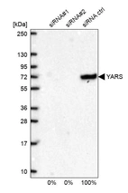 Western blot analysis in U2OS cells transfected with control siRNA, target specific siRNA probe #1 and #2, using Anti-YARS antibody. Remaining relative intensity is presented.