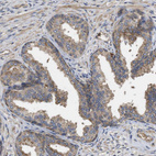 Immunohistochemical staining of human Prostate shows moderate cytoplasmic positivity in glandular cells.