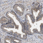 Immunohistochemical staining of human Prostate shows moderate cytoplasmic positivity in glandular cells.