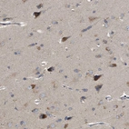 Immunohistochemical staining of human Cerebral cortex shows moderate nuclear and cytoplasmic positivity in neuronal cells.