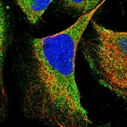 Immunofluorescent staining of human cell line U-2 OS shows localization to cytosol.