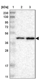 Lane 1: Marker [kDa] 230, 130, 95, 72, 56, 36, 28, 17, 11_br/_Lane 2: Human cell line RT-4_br/_Lane 3: Human cell line U-251MG sp