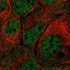 Immunofluorescent staining of human cell line A-431 shows localization to nucleoplasm & cytosol.