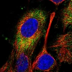 Immunofluorescent staining of human cell line U-251 MG shows localization to vesicles.