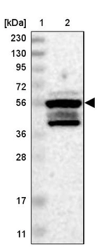 Lane 1: Marker [kDa] 230, 130, 95, 72, 56, 36, 28, 17, 11_br/_Lane 2: Human cell line RT-4