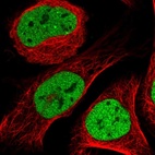 Immunofluorescent staining of human cell line U-2 OS shows localization to nucleoplasm.