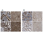 Anti-ETFA Antibody