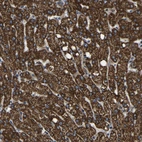 Immunohistochemical staining of human liver shows strong granular cytoplasmic positivity in hepatocytes.
