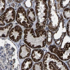 Immunohistochemical staining of human kidney shows strong granular cytoplasmic positivity in cells in tubules.