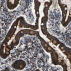 Immunohistochemical staining of human duodenum shows strong granular cytoplasmic positivity in glandular cells.