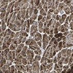 Immunohistochemical staining of human heart muscle shows strong granular cytoplasmic positivity in cardiomyocytes.