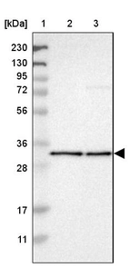 Lane 1: Marker [kDa] 230, 130, 95, 72, 56, 36, 28, 17, 11_br/_Lane 2: Human cell line RT-4_br/_Lane 3: Human cell line U-251MG sp
